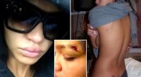 Disturbing new photos show Cassie Ventura?s gruesome injuries from ex-boyfriend Diddy