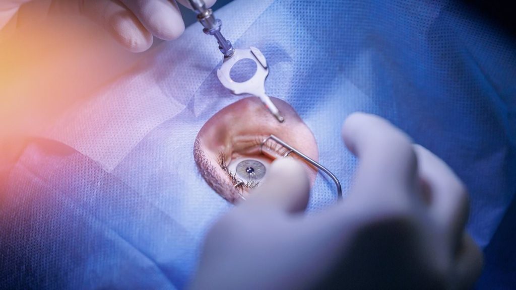 Terrifying number of patients have taken their lives after Lasik