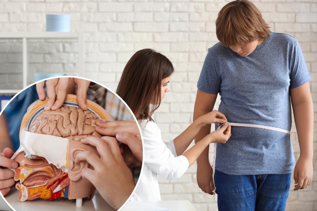 The ‘particularly alarming’ ways obesity affects teenage brains: study