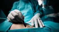The US states where doctors are most likely to bungle your surgery