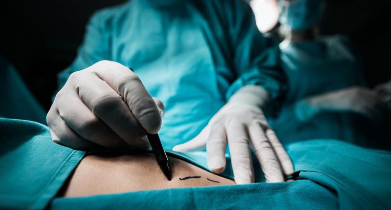 The US states where doctors are most likely to bungle your surgery