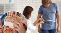 The ‘particularly alarming’ ways obesity affects teenage brains: study