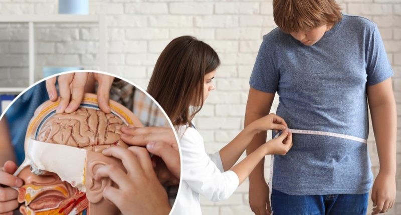 The ‘particularly alarming’ ways obesity affects teenage brains: study