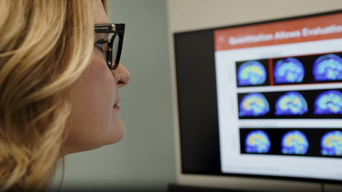 A first-of-its-kind treatment to slow the symptoms of early Alzheimer's disease has been approved for use in Australia.