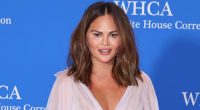 Chrissy Teigen Shows Her Bandaged Face on Instagram Live