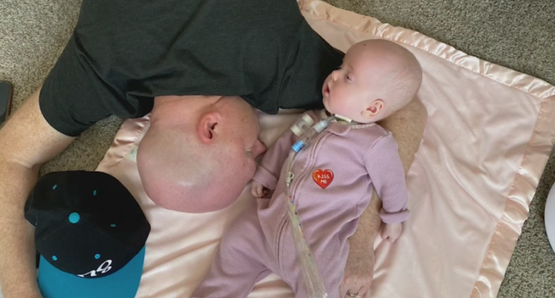 Family embraces life with baby battling rare, fatal genetic disorder