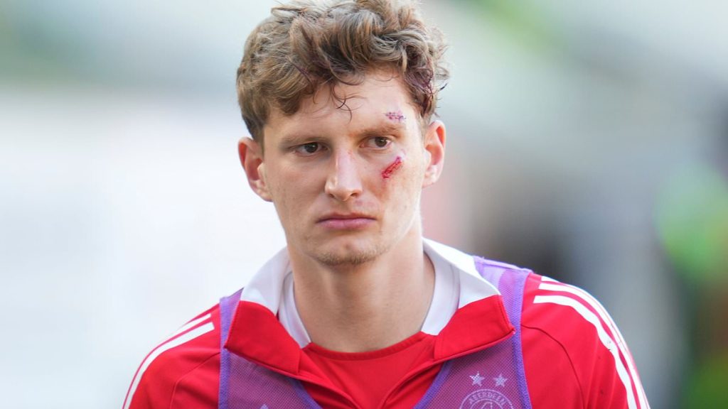 Footballer left bloodied and needing stitches after being hit by an object thrown by his OWN fans during pitch invasion