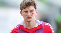 Footballer left bloodied and needing stitches after being hit by an object thrown by his OWN fans during pitch invasion