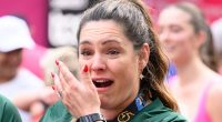 Kelly Brook opens up on the extent of her London Marathon injury