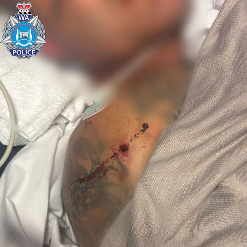 WA Police released some images showing the extent of the man's injuries.