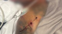 WA Police released some images showing the extent of the man's injuries.