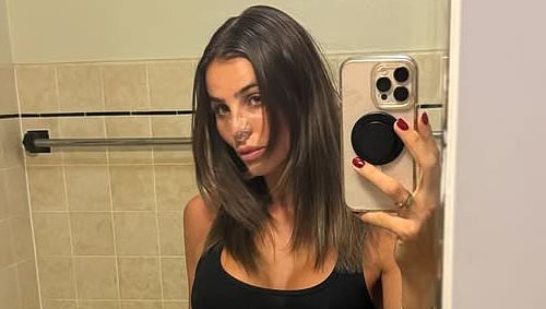 TikTok star Indy Clinton shows off her bandaged nose
