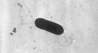 What to know about food poisoning illnesses caused by listeria