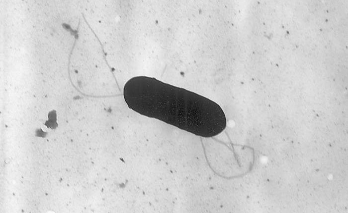 What to know about food poisoning illnesses caused by listeria