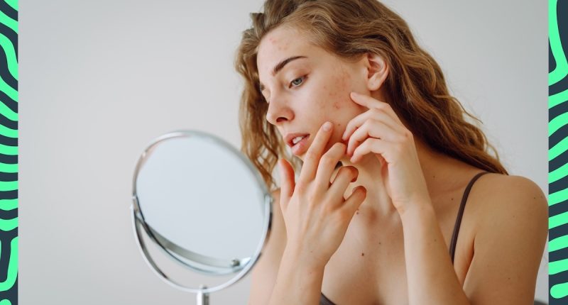 7 Foods That Can Cause Terrible Adult Acne