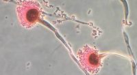 Deadly fungus that 'eats you from the inside out' invades US