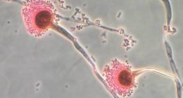 Deadly fungus that 'eats you from the inside out' invades US