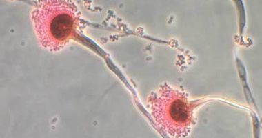 Deadly fungus that 'eats you from the inside out' invades US