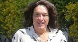 Iconic '80s singer born without an ear looks nearly unrecognizable