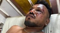 A doctor said he had examined the sole survivor of the Air India crash, whom he identified as Vishwash Kumar Ramesh.