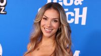 Allison Holker Reveals Just How Much Botox She Gets — And Where