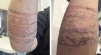 Kerrie-Anne Graf's son had a severe reaction to a 'black henna' tattoo in Bali.
