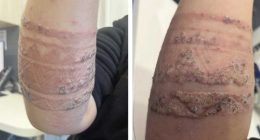 Kerrie-Anne Graf's son had a severe reaction to a 'black henna' tattoo in Bali.