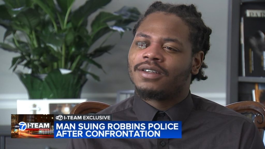 Chicago man Dominic Bradford suffers permanent eye damage after Taser used by Robbins Police Department officer: I-TEAM EXCLUSIVE