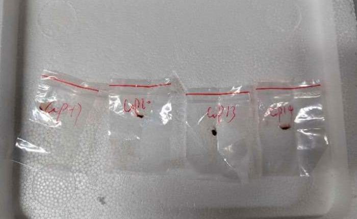FBI says it broke up effort to bring toxic fungus to Michigan lab from China