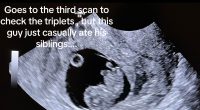 I was pregnant with triplets but only delivered one baby after my son 'ate his siblings' in the womb