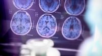 Illinois becomes first state to require that all insurance covers Alzheimer’s treatment