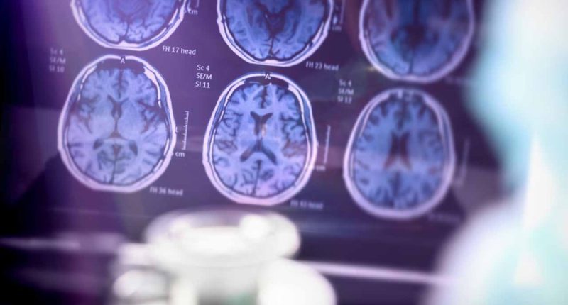 Illinois becomes first state to require that all insurance covers Alzheimer’s treatment