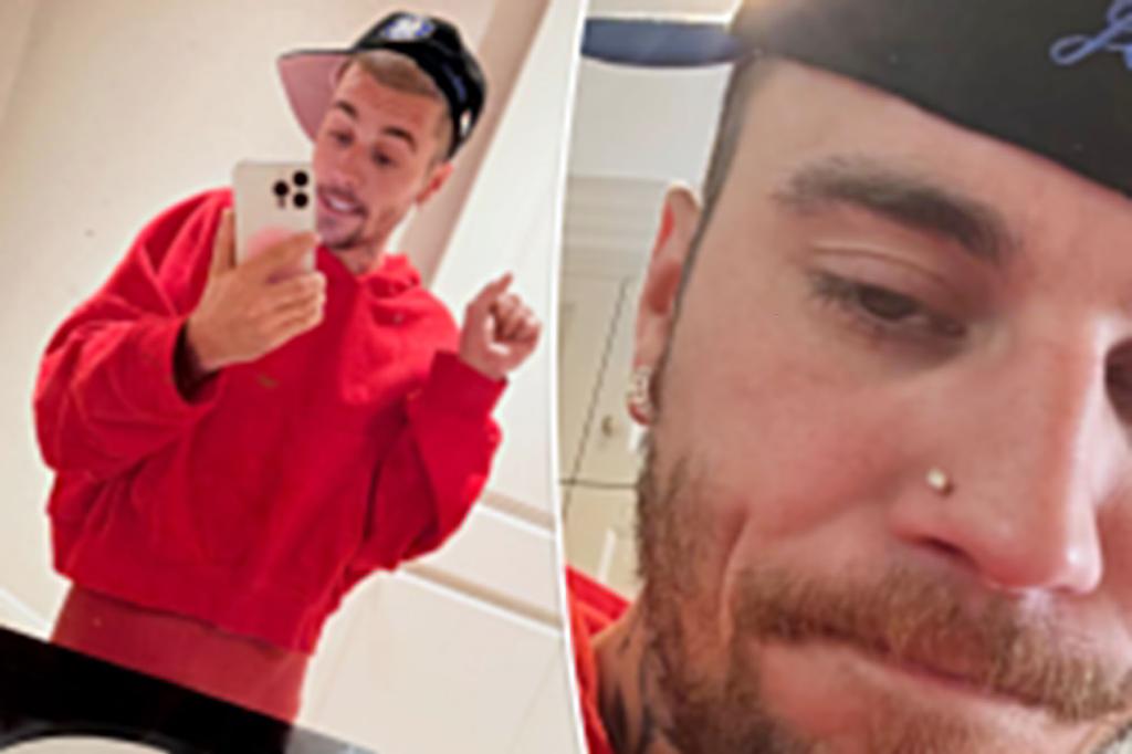 Justin Bieber fans beg him to ‘get help’ as he appears to be ‘seriously struggling’ in new photos: ‘Sad to watch’