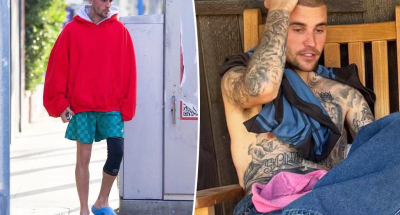 Justin Bieber reveals mystery injury as he continues sparking concern with odd behavior