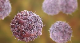 Understanding and beating prostate cancer