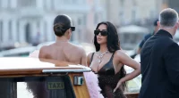 What’s Going On With Kim Kardashian’s Armpit? A Plastic Surgeon Explains