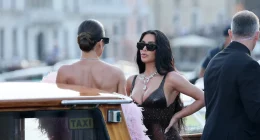 What’s Going On With Kim Kardashian’s Armpit? A Plastic Surgeon Explains