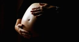 America has a birthing problem — let’s make maternal care more accessible  