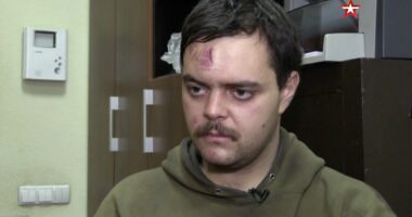 Aiden Aslin, a British fighter for Ukraine, with a head wound.