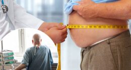 Cancer deaths from obesity have tripled in 20 years: study