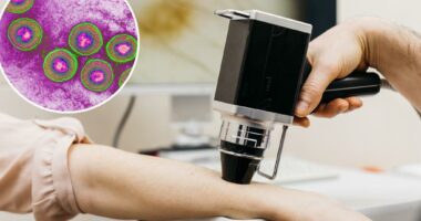 Doctors using herpes to fight untreatable advanced cancer