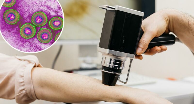 Doctors using herpes to fight untreatable advanced cancer