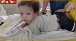 Toddler in India who bit a venomous cobra.