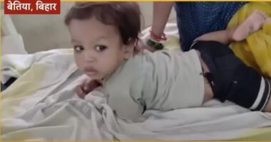 Toddler in India who bit a venomous cobra.
