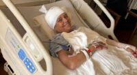 Woman in hospital bed recovering from dog attack.