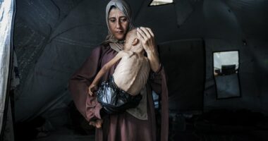 Horrifying story behind photo of starving child in Gaza