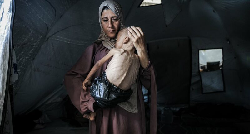 Horrifying story behind photo of starving child in Gaza