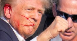 Close-up of Donald Trump with a bloody face.