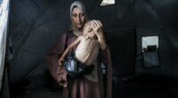 Malnourished child held by his mother in a tent.