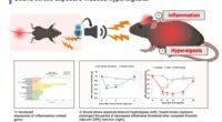 New study reveals sound can trigger inflammation